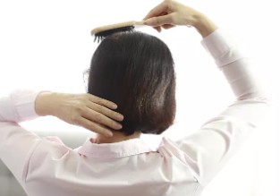 夏天头发容易油又容易掉？